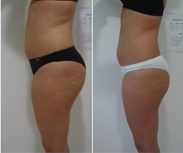 Meu corpo, minhas regras!