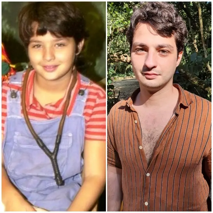 Pedrinho: Antes e depois no Sítio do Pica Pau Amarelo ator César Cardadeiro