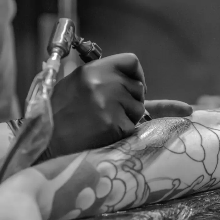 Remoção de Tatuagem em Juiz de Fora: Nu Laser