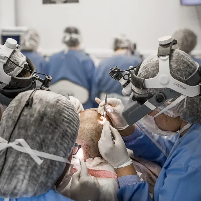 Transplante Capilar em Juiz de Fora: como é feito o implante 